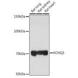 Western Blot - Anti-KCNQ1 Antibody (A13931) - Antibodies.com