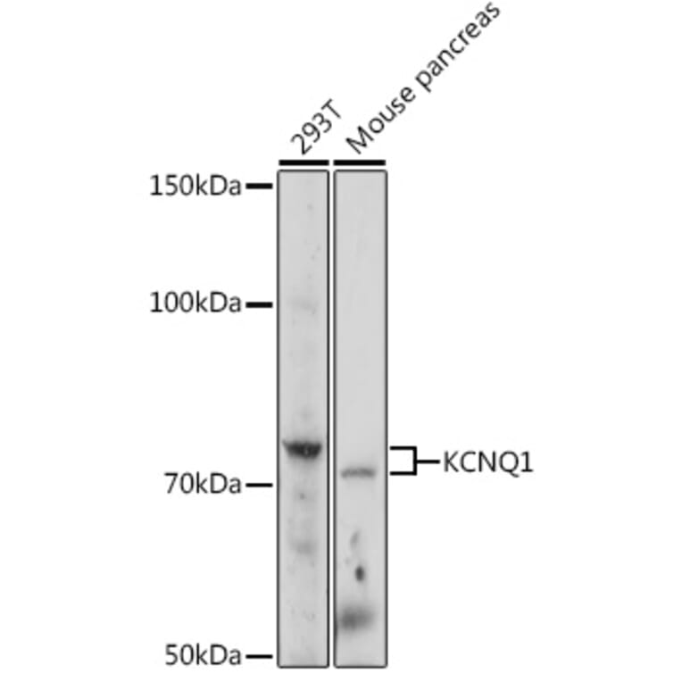 Western Blot - Anti-KCNQ1 Antibody (A13931) - Antibodies.com