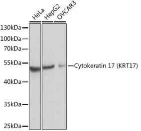 Western Blot - Anti-Cytokeratin 17 Antibody (A13932) - Antibodies.com