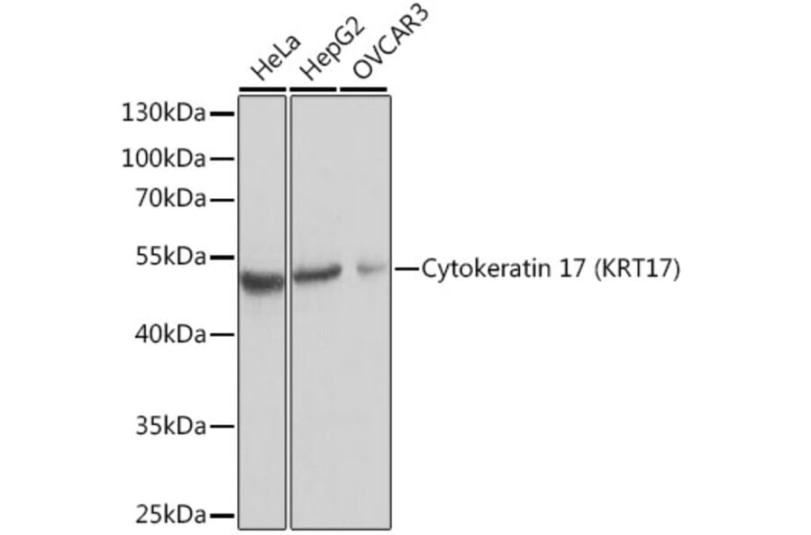 Western Blot - Anti-Cytokeratin 17 Antibody (A13932) - Antibodies.com