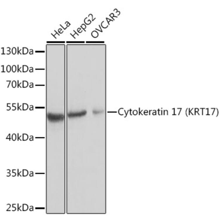 Western Blot - Anti-Cytokeratin 17 Antibody (A13932) - Antibodies.com