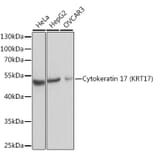 Western Blot - Anti-Cytokeratin 17 Antibody (A13932) - Antibodies.com