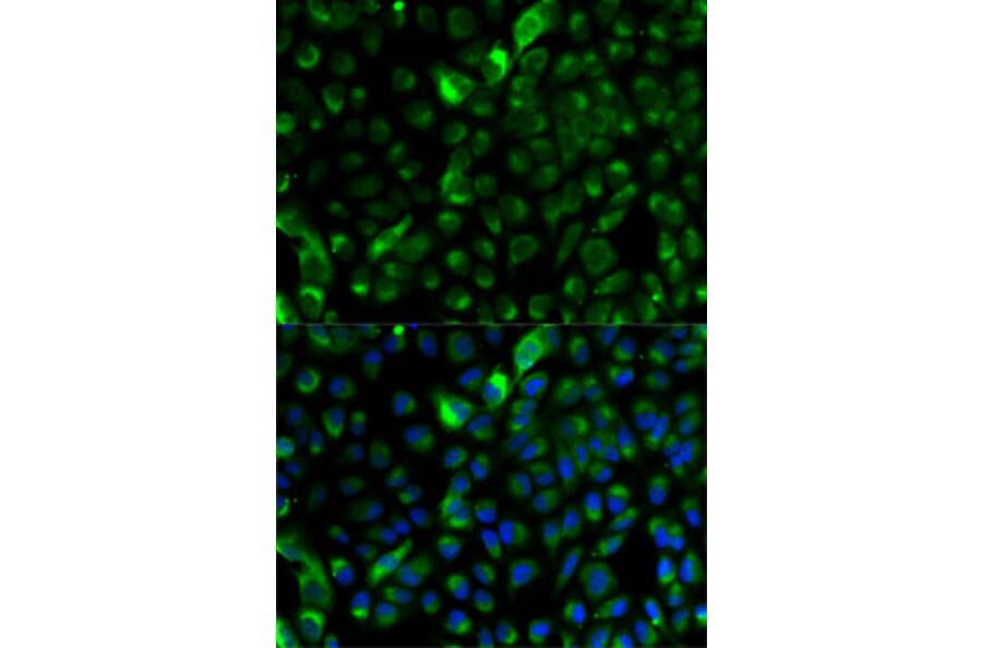 Immunofluorescence - Anti-Cytokeratin 17 Antibody (A13932) - Antibodies.com