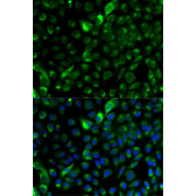 Immunofluorescence - Anti-Cytokeratin 17 Antibody (A13932) - Antibodies.com