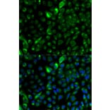 Immunofluorescence - Anti-Cytokeratin 17 Antibody (A13932) - Antibodies.com