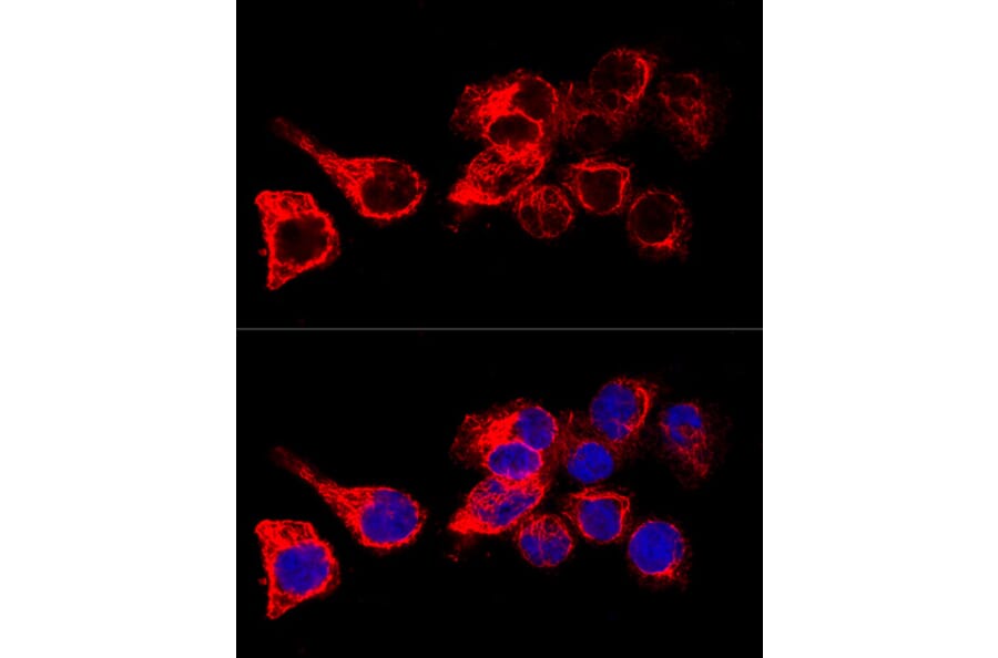 Immunofluorescence - Anti-Cytokeratin 17 Antibody (A13932) - Antibodies.com
