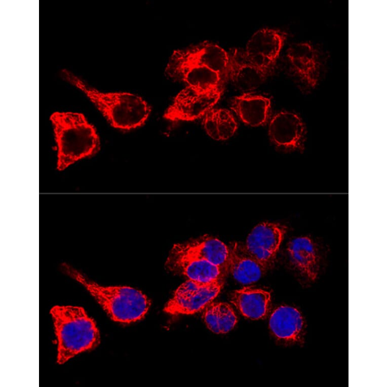 Immunofluorescence - Anti-Cytokeratin 17 Antibody (A13932) - Antibodies.com