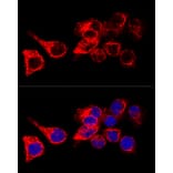Immunofluorescence - Anti-Cytokeratin 17 Antibody (A13932) - Antibodies.com