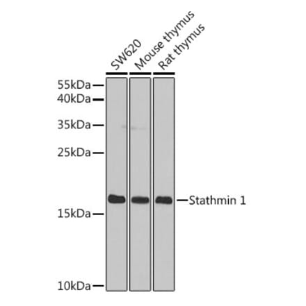 Western Blot - Anti-Stathmin 1 Antibody (A13933) - Antibodies.com