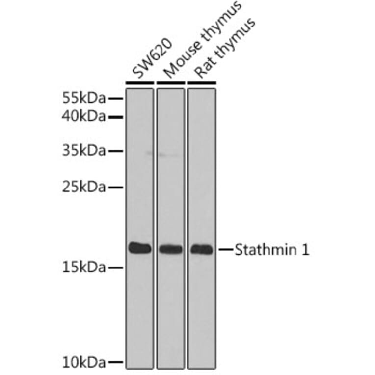 Western Blot - Anti-Stathmin 1 Antibody (A13933) - Antibodies.com