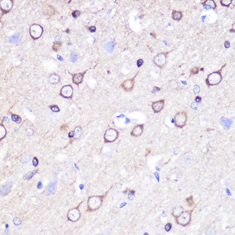 Immunohistochemistry - Anti-Stathmin 1 Antibody (A13933) - Antibodies.com