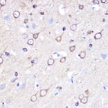 Immunohistochemistry - Anti-Stathmin 1 Antibody (A13933) - Antibodies.com