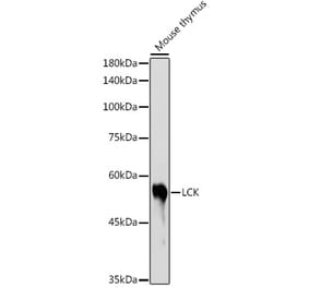 Western Blot - Anti-Lck Antibody (A13934) - Antibodies.com