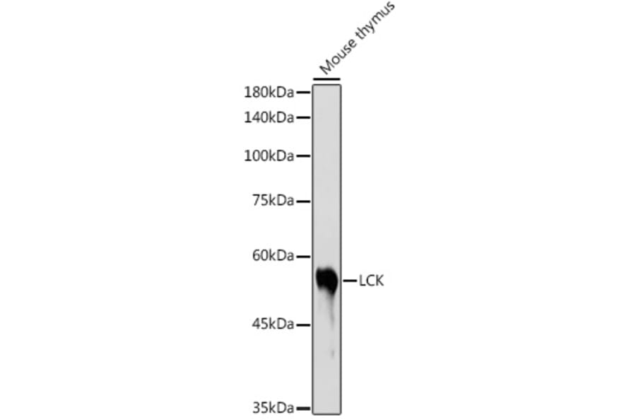 Western Blot - Anti-Lck Antibody (A13934) - Antibodies.com