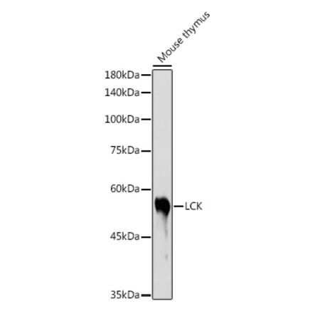 Western Blot - Anti-Lck Antibody (A13934) - Antibodies.com