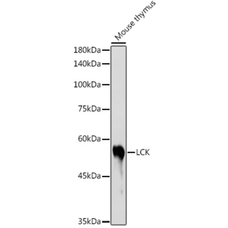 Western Blot - Anti-Lck Antibody (A13934) - Antibodies.com