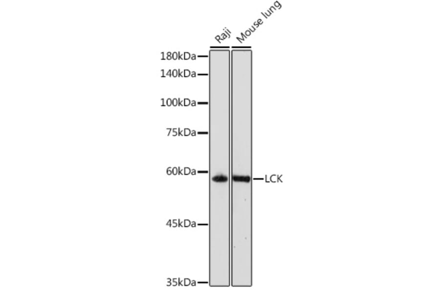 Western Blot - Anti-Lck Antibody (A13934) - Antibodies.com