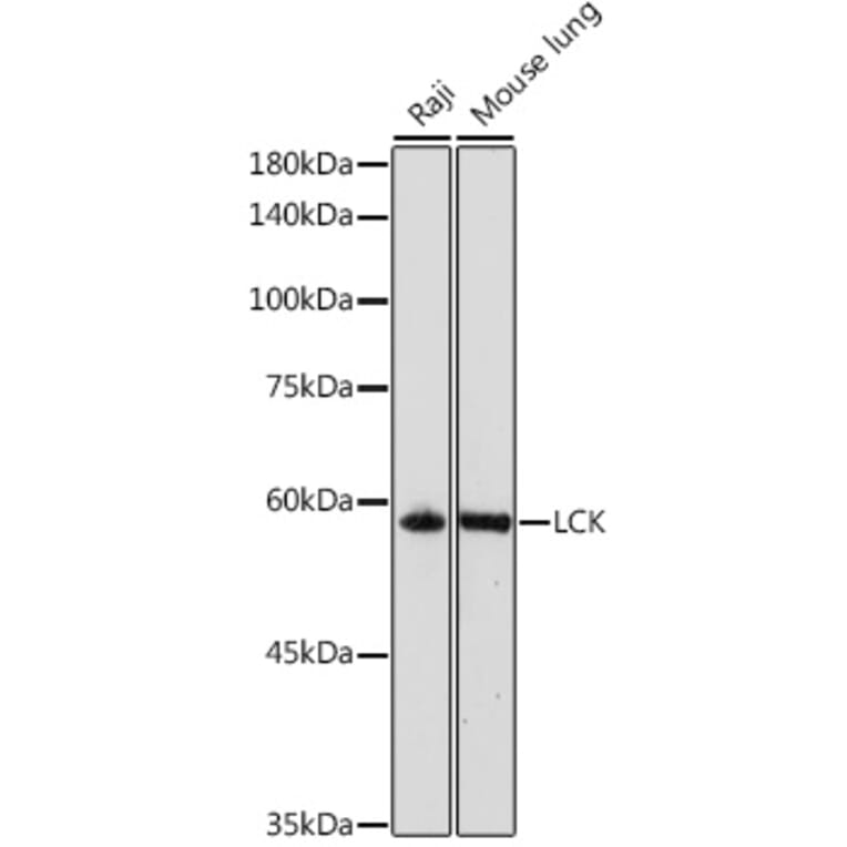 Western Blot - Anti-Lck Antibody (A13934) - Antibodies.com