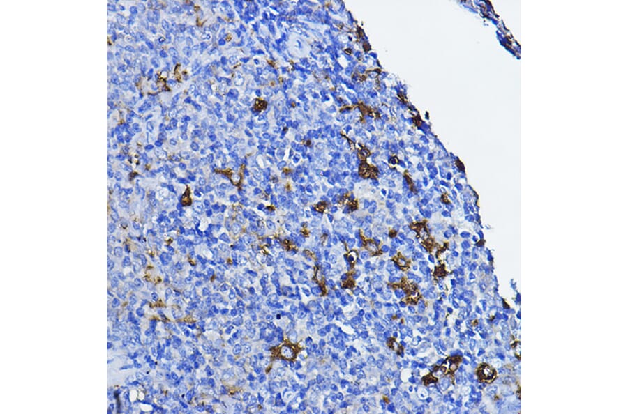 Immunohistochemistry - Anti-Lck Antibody (A13934) - Antibodies.com