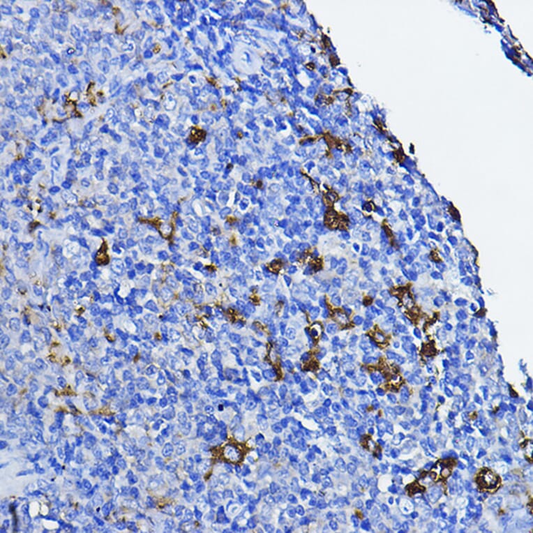 Immunohistochemistry - Anti-Lck Antibody (A13934) - Antibodies.com