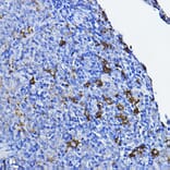 Immunohistochemistry - Anti-Lck Antibody (A13934) - Antibodies.com