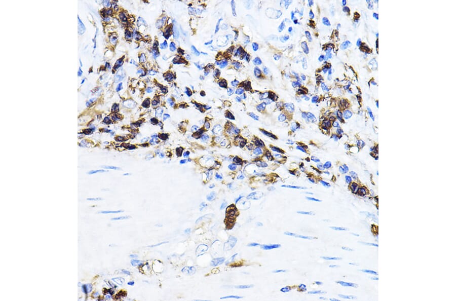 Immunohistochemistry - Anti-Lck Antibody (A13934) - Antibodies.com