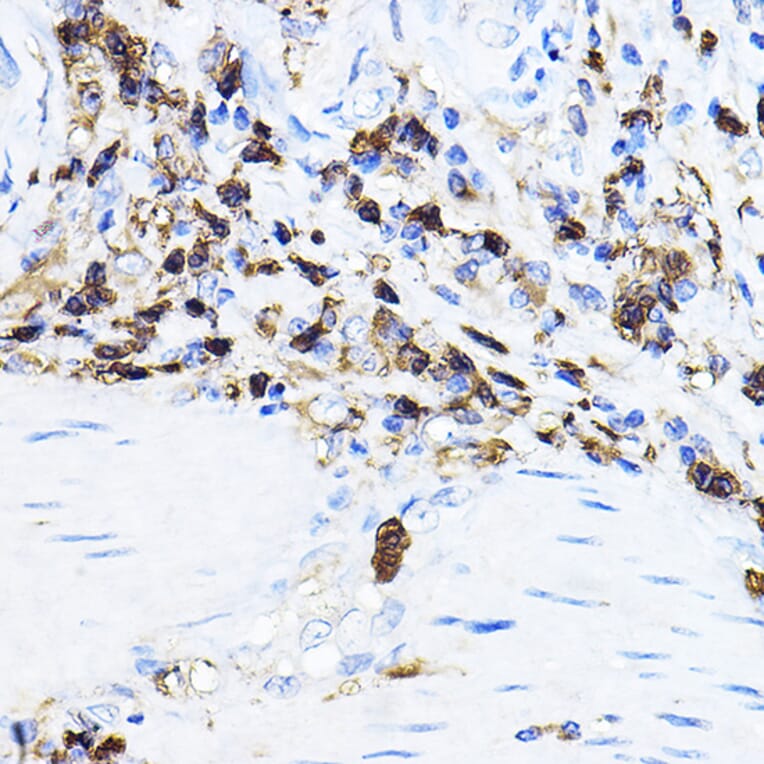 Immunohistochemistry - Anti-Lck Antibody (A13934) - Antibodies.com