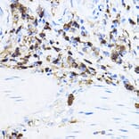 Immunohistochemistry - Anti-Lck Antibody (A13934) - Antibodies.com