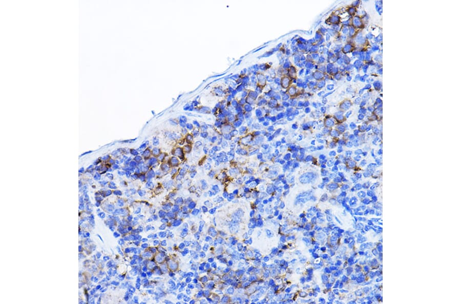 Immunohistochemistry - Anti-Lck Antibody (A13934) - Antibodies.com