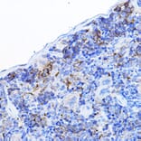 Immunohistochemistry - Anti-Lck Antibody (A13934) - Antibodies.com