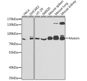 Western Blot - Anti-Moesin Antibody (A13935) - Antibodies.com