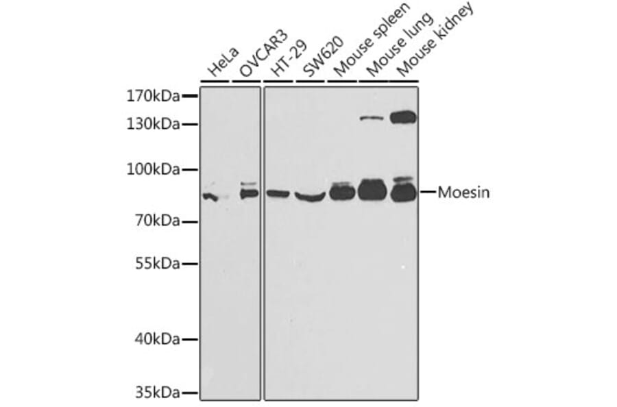 Western Blot - Anti-Moesin Antibody (A13935) - Antibodies.com