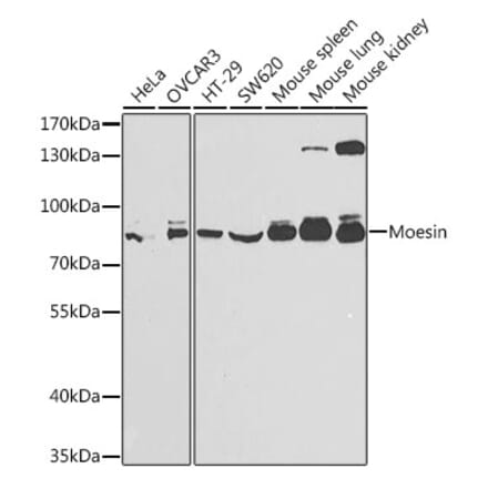 Western Blot - Anti-Moesin Antibody (A13935) - Antibodies.com