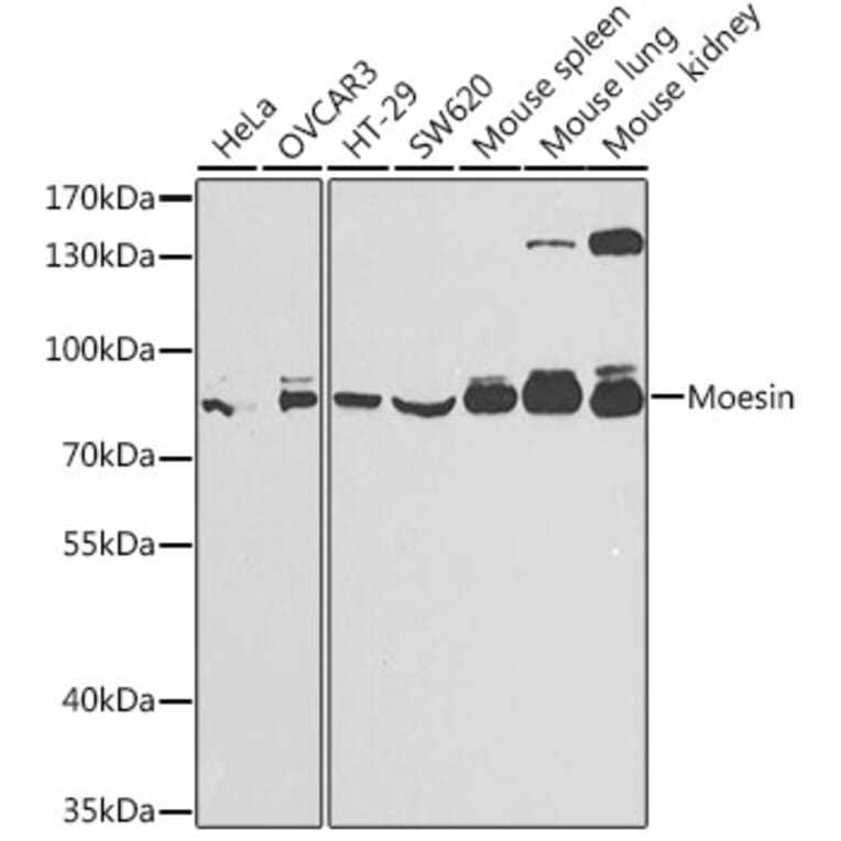 Western Blot - Anti-Moesin Antibody (A13935) - Antibodies.com
