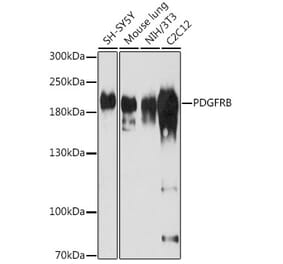 Western Blot - Anti-PDGFR beta Antibody (A13936) - Antibodies.com