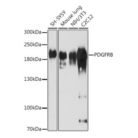 Western Blot - Anti-PDGFR beta Antibody (A13936) - Antibodies.com