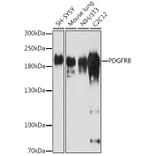 Western Blot - Anti-PDGFR beta Antibody (A13936) - Antibodies.com