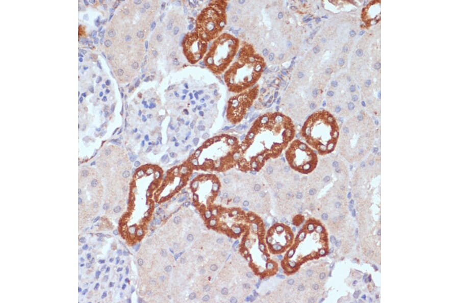 Immunohistochemistry - Anti-PDGFR beta Antibody (A13936) - Antibodies.com