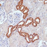 Immunohistochemistry - Anti-PDGFR beta Antibody (A13936) - Antibodies.com