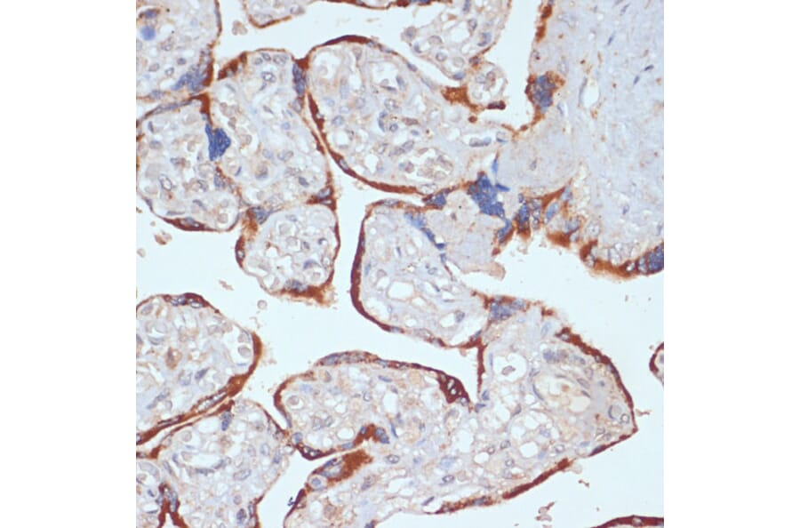 Immunohistochemistry - Anti-PDGFR beta Antibody (A13936) - Antibodies.com