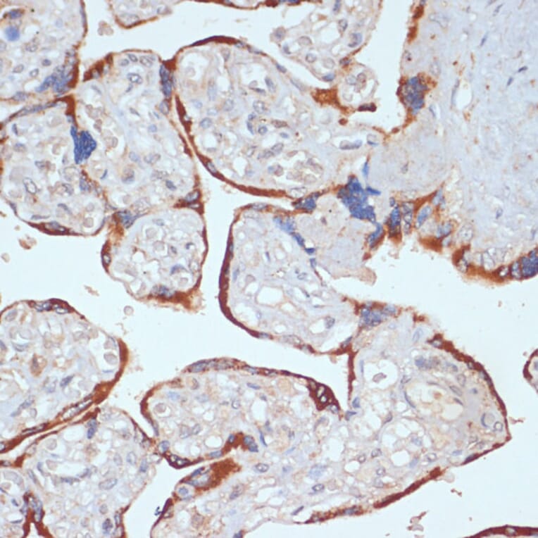Immunohistochemistry - Anti-PDGFR beta Antibody (A13936) - Antibodies.com