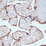 Immunohistochemistry - Anti-PDGFR beta Antibody (A13936) - Antibodies.com