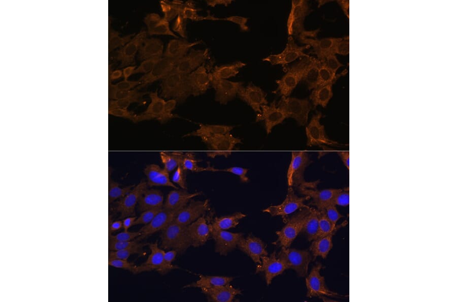 Immunofluorescence - Anti-PDGFR beta Antibody (A13936) - Antibodies.com