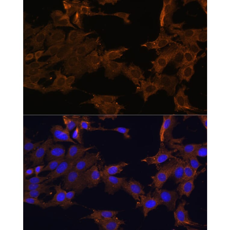 Immunofluorescence - Anti-PDGFR beta Antibody (A13936) - Antibodies.com