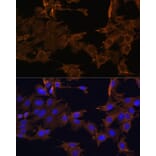 Immunofluorescence - Anti-PDGFR beta Antibody (A13936) - Antibodies.com