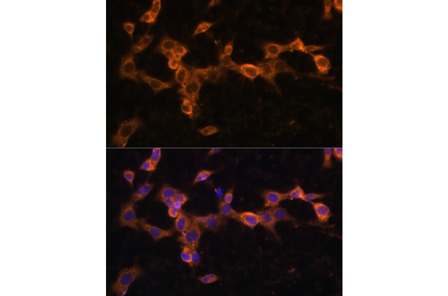 Immunofluorescence - Anti-PDGFR beta Antibody (A13936) - Antibodies.com