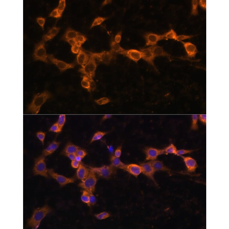 Immunofluorescence - Anti-PDGFR beta Antibody (A13936) - Antibodies.com
