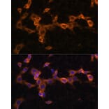 Immunofluorescence - Anti-PDGFR beta Antibody (A13936) - Antibodies.com