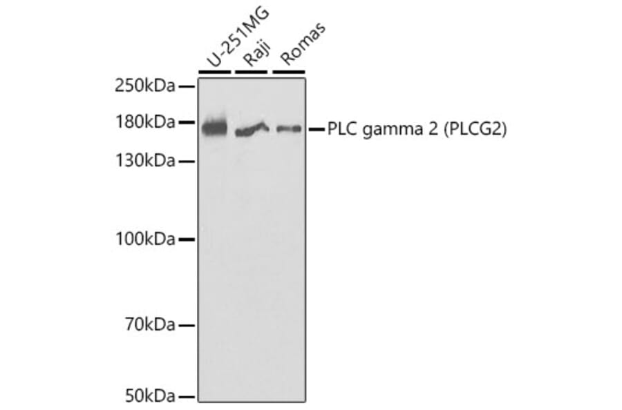 Western Blot - Anti-PLCG 2 Antibody (A13937) - Antibodies.com