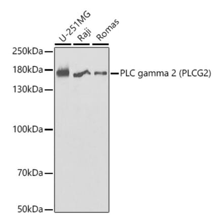 Western Blot - Anti-PLCG 2 Antibody (A13937) - Antibodies.com
